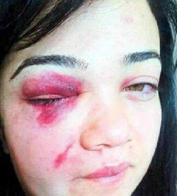 d Elektronik kelepçeyi kırdı, mahkeme bırakmadı