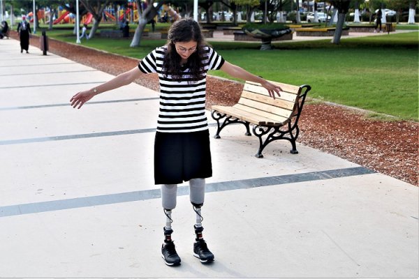 a Buket Öğretmen'in protez bacakla ilk adım heyecanı