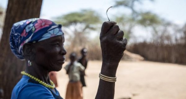 Dünya genelinde 200 milyon kadın sünnetli