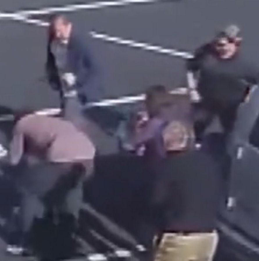 ABD'de küçük kıza köpek saldırdı