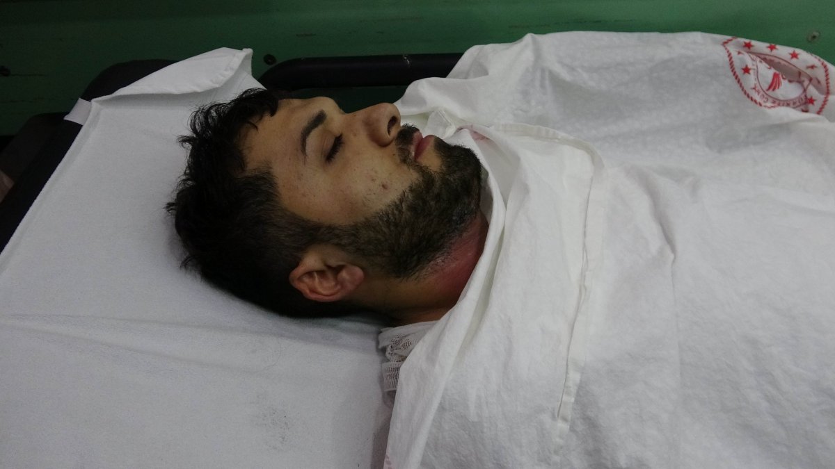 i Samsun'da bir fabrikada 1'i ağır, 2 işçi yaralandı