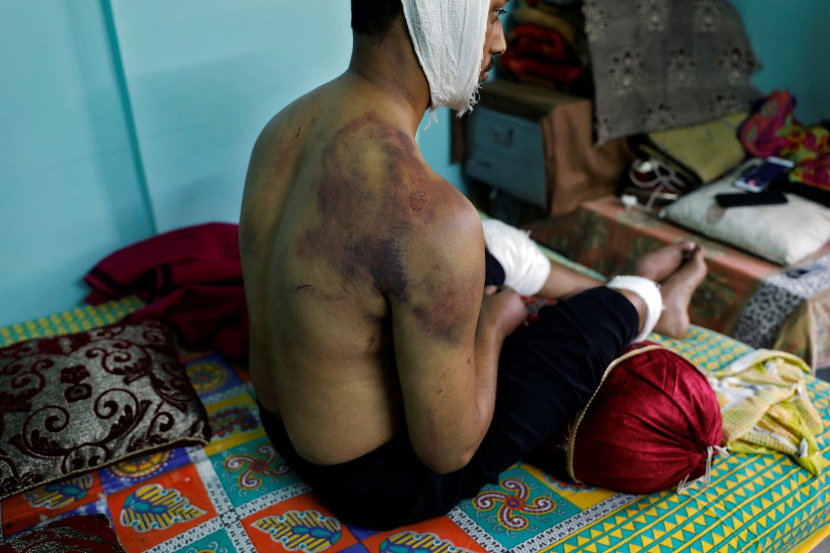 r Hindistan'da öldüresiye dövülen Müslüman, dehşeti anlattı