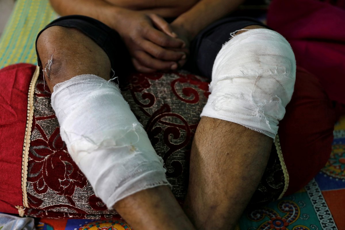 r Hindistan'da öldüresiye dövülen Müslüman, dehşeti anlattı