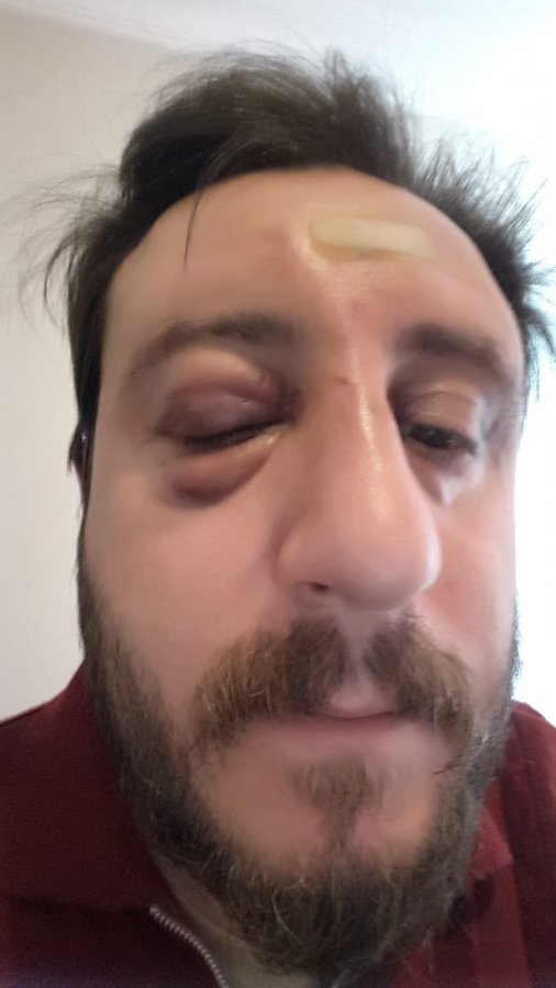 i İstanbul'da gürültü tartışması apartmanı birbirine kattı