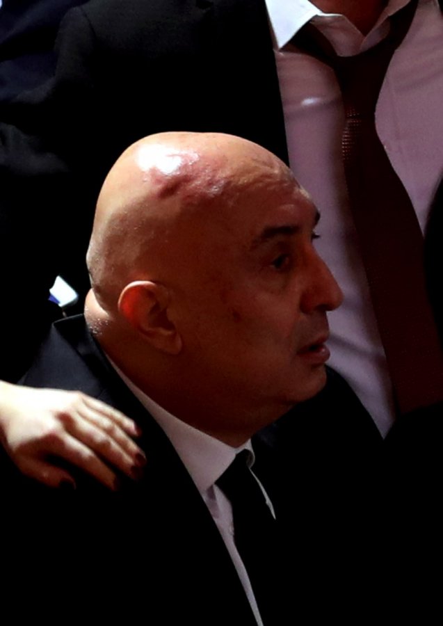 Kavga sonrası Engin Özkoç’un hali