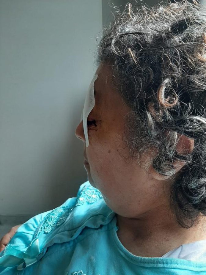 d Oda arkadaşının gözlerini oyan kadının cinayeti çıktı