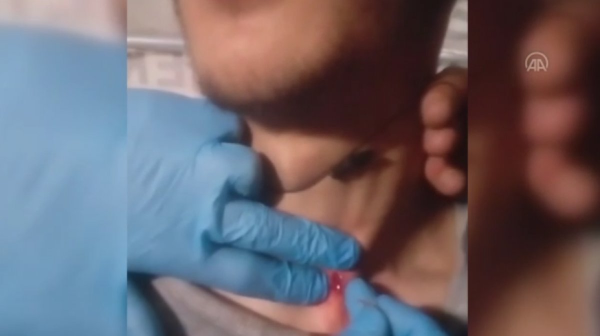 a Yunan askeri, plastik mermiye tel yerleştirdi