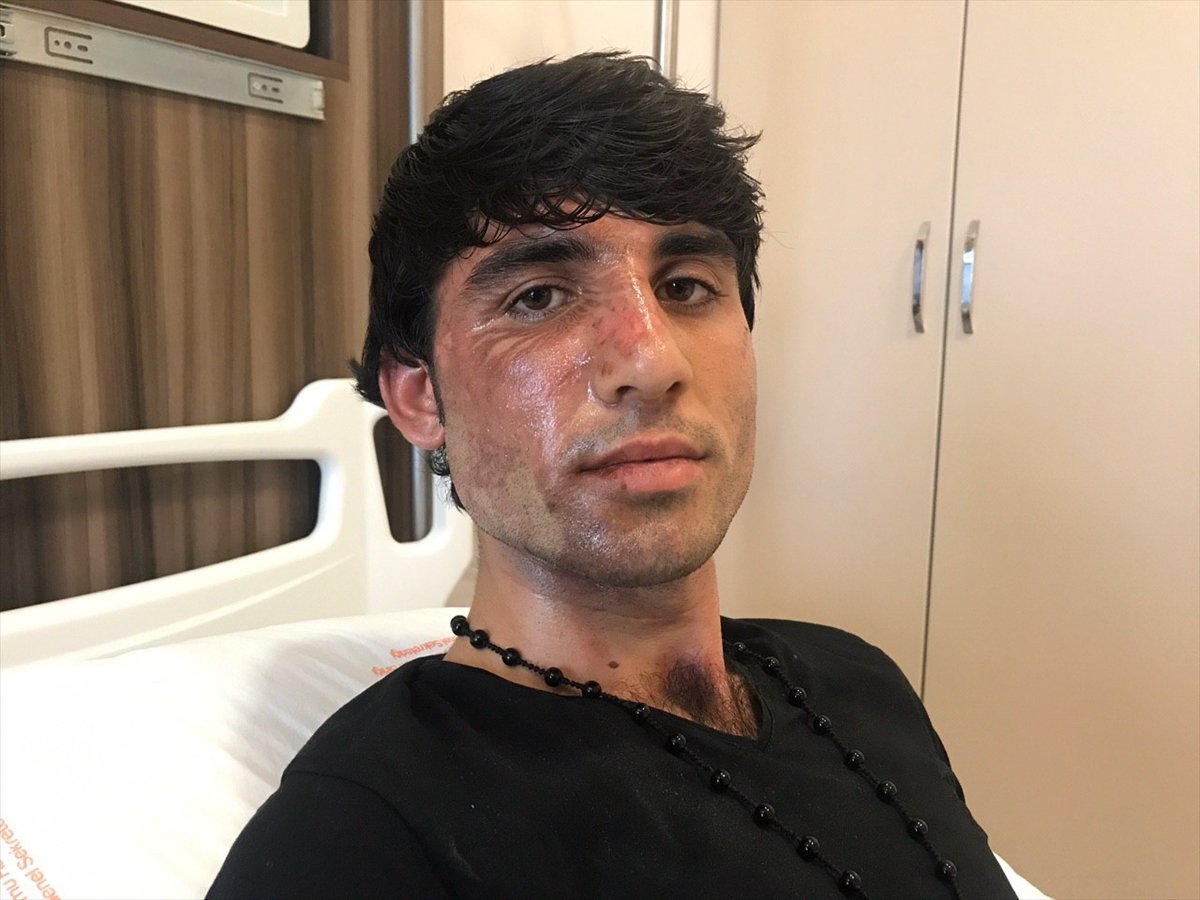 Yunan sınır polisi, sığınmacının üzerine kaynar su döktü