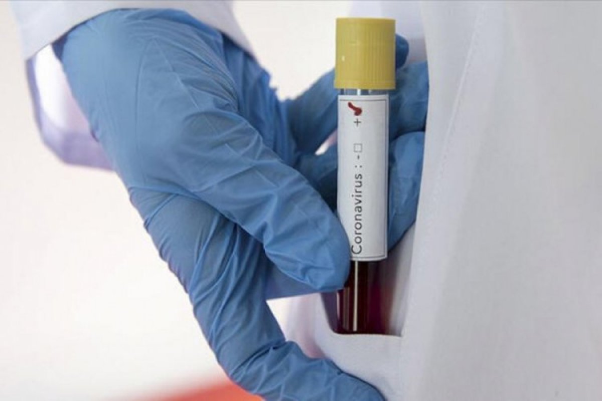 ABD'de koronavirüs kaynaklı can kaybı 85'e yükseldi