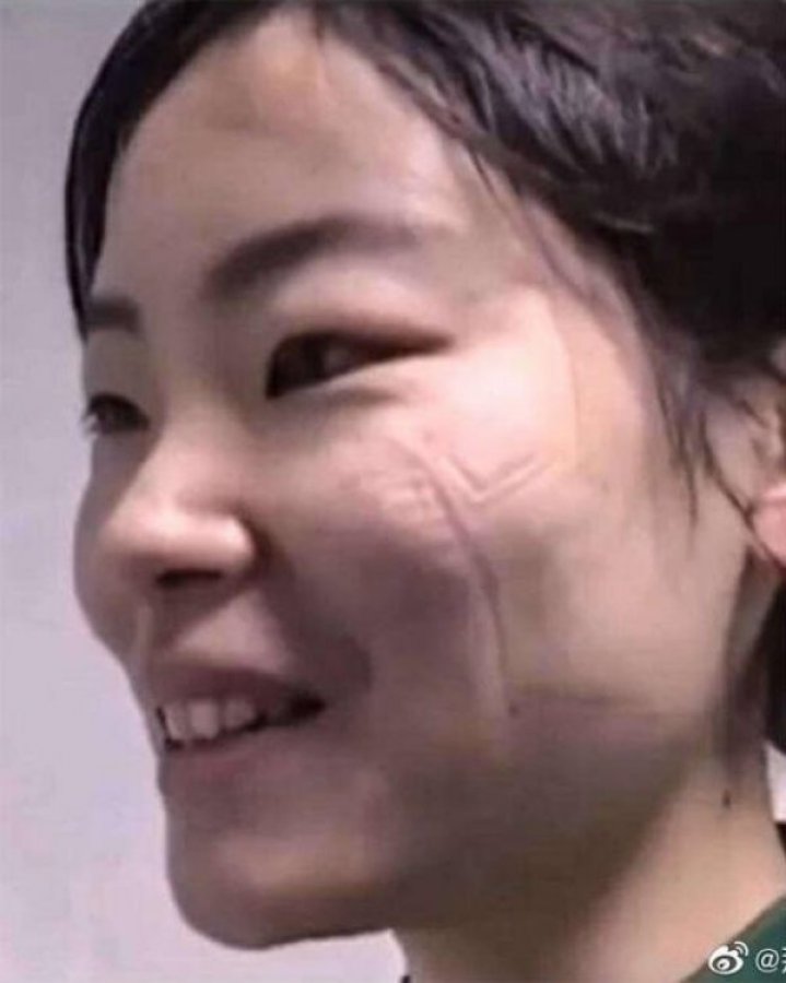 İtalyan doktorların koronayla mücadelesi