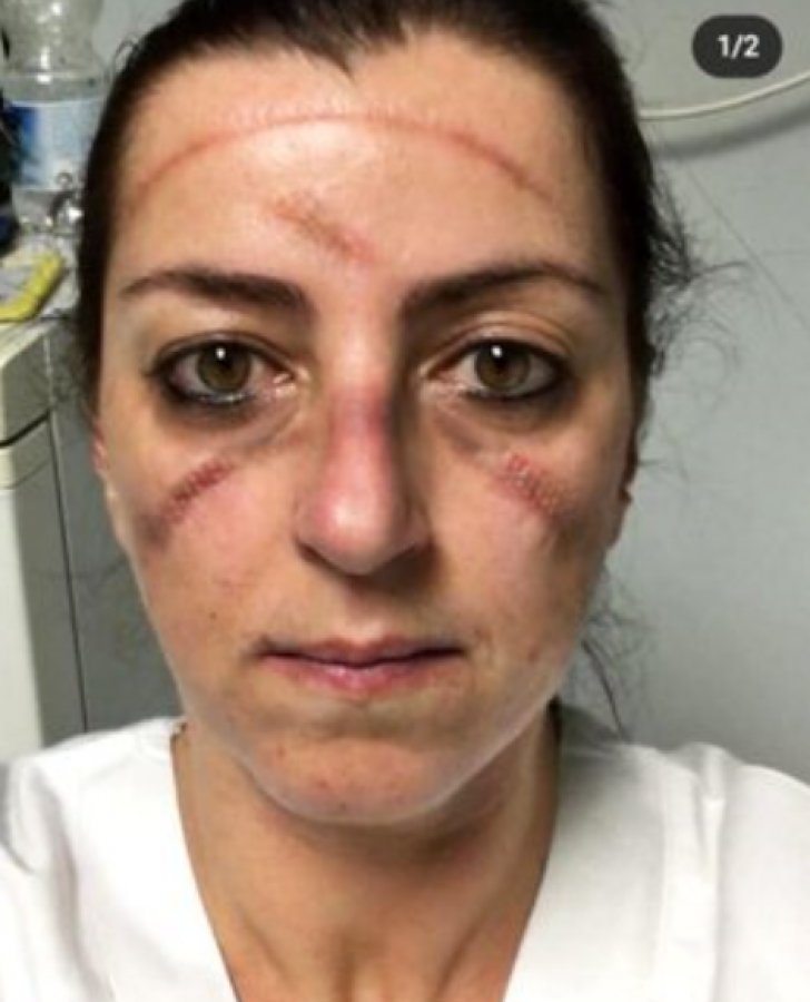 İtalyan doktorların koronayla mücadelesi