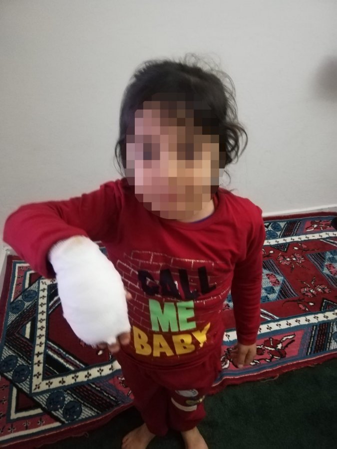 Şanlıurfa'da sokak köpekleri 6 çocuğa saldırdı