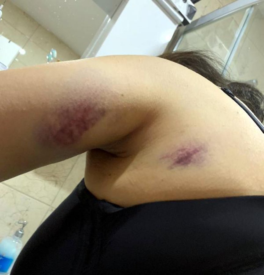 d Esenyurt'ta eski eşini kaçırıp, darbeden zanlı tutuklandı