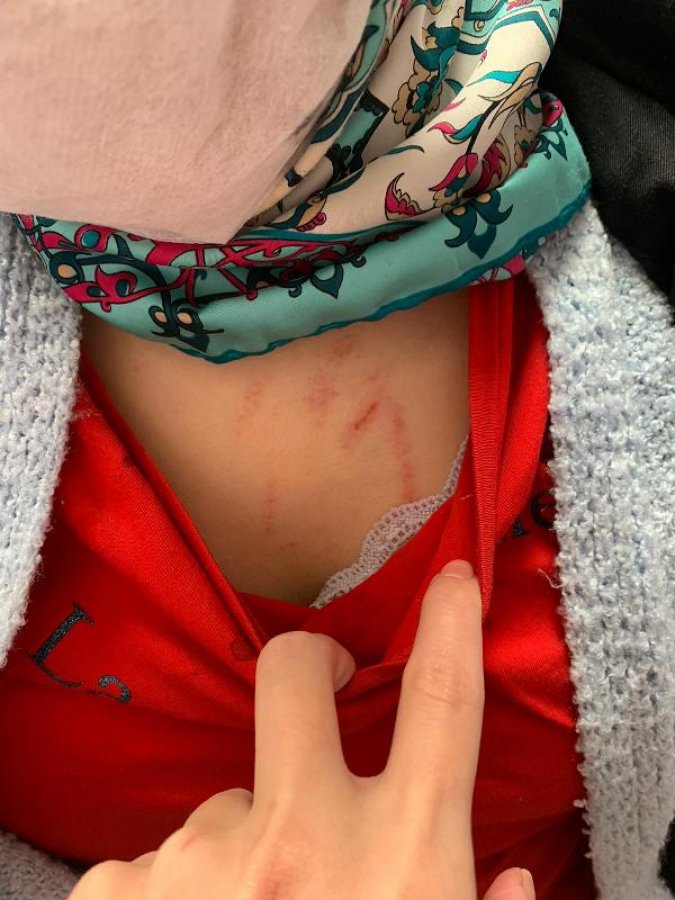 d Esenyurt'ta eski eşini kaçırıp, darbeden zanlı tutuklandı