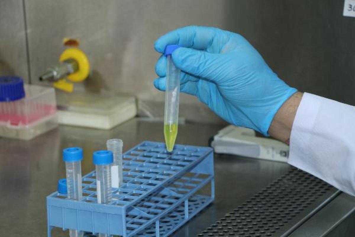 Çukurova Üniversitesi, koronaya alternatif tedavi geliştirdi