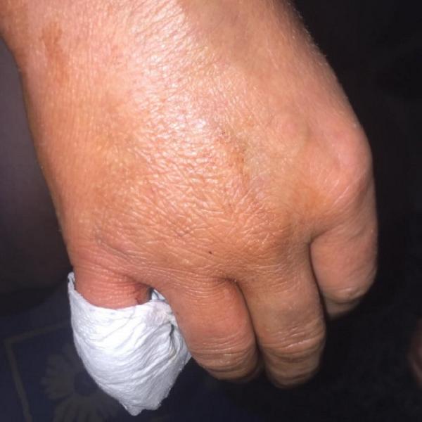 d Babasından şiddet gören annesi için yardım istedi