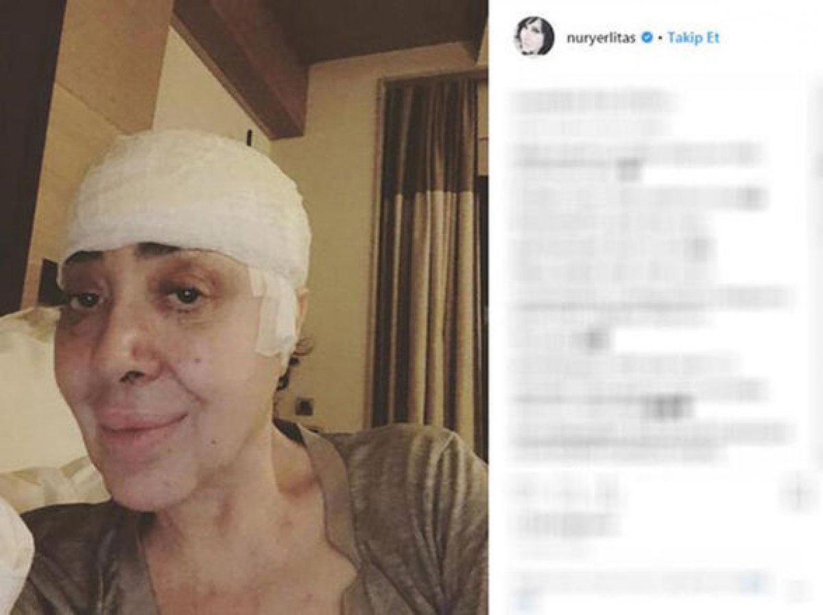 Nur Yerlitaş vefat etti