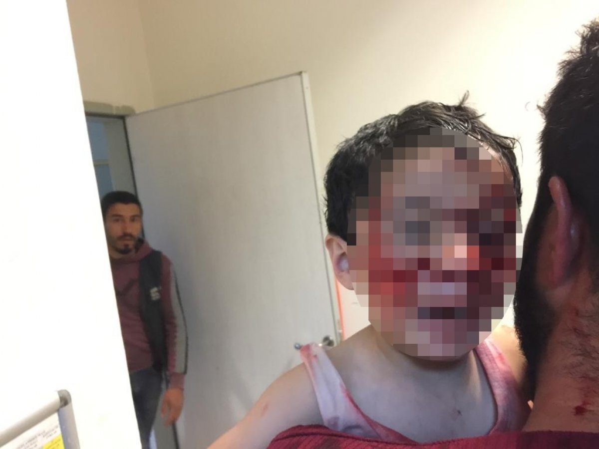 i Şanlıurfa'da şimdi de bir sokak köpeği öldürüldü