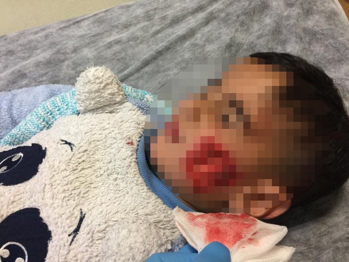 i Şanlıurfa'da şimdi de bir sokak köpeği öldürüldü