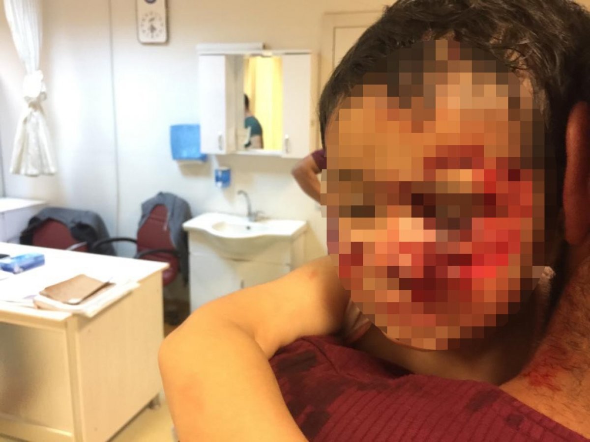 i Şanlıurfa'da şimdi de bir sokak köpeği öldürüldü