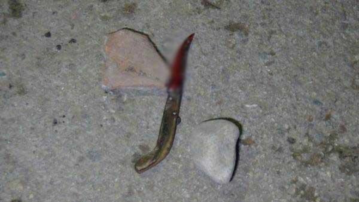 d Ablasıyla boşanma aşamasında olan eniştesini bıçakladı