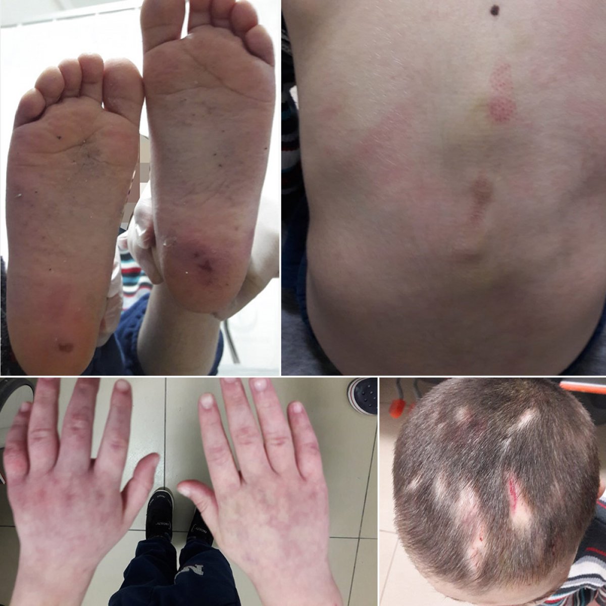 Tekirdağ'da 7 yaşındaki çocuğu üvey babası darbetti