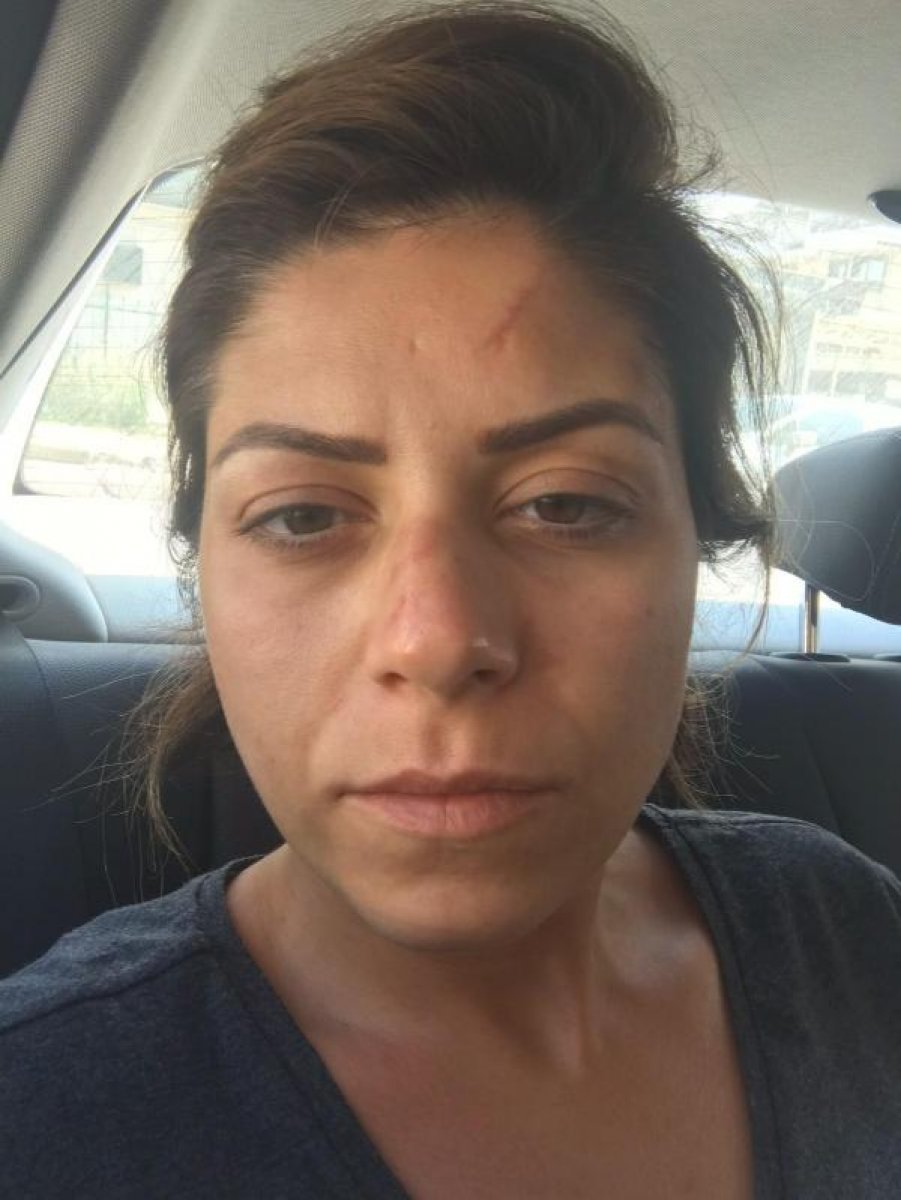 İzmit’te kadın avukat, eski eşinden şiddet gördü