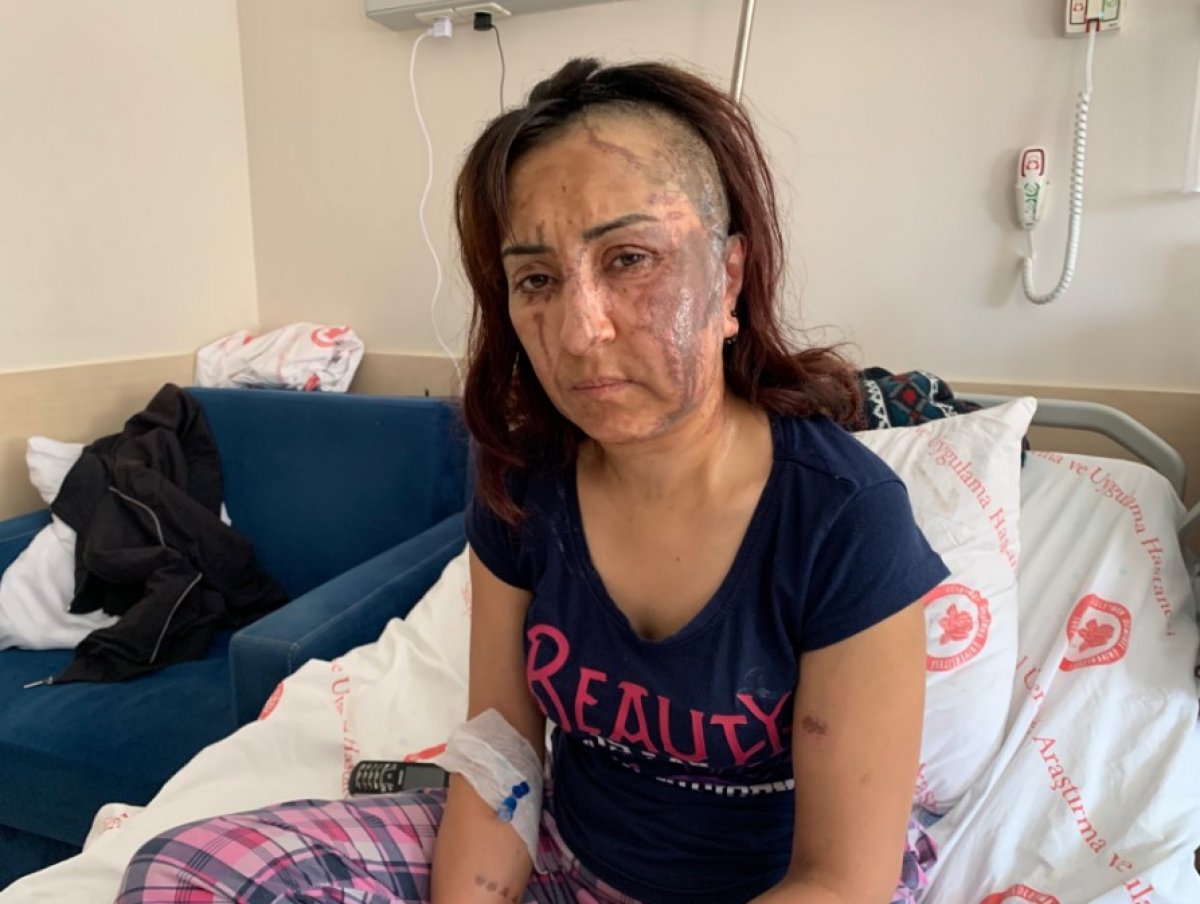 i Isparta’da boşanmak isteyen kadına kezzaplı saldırı