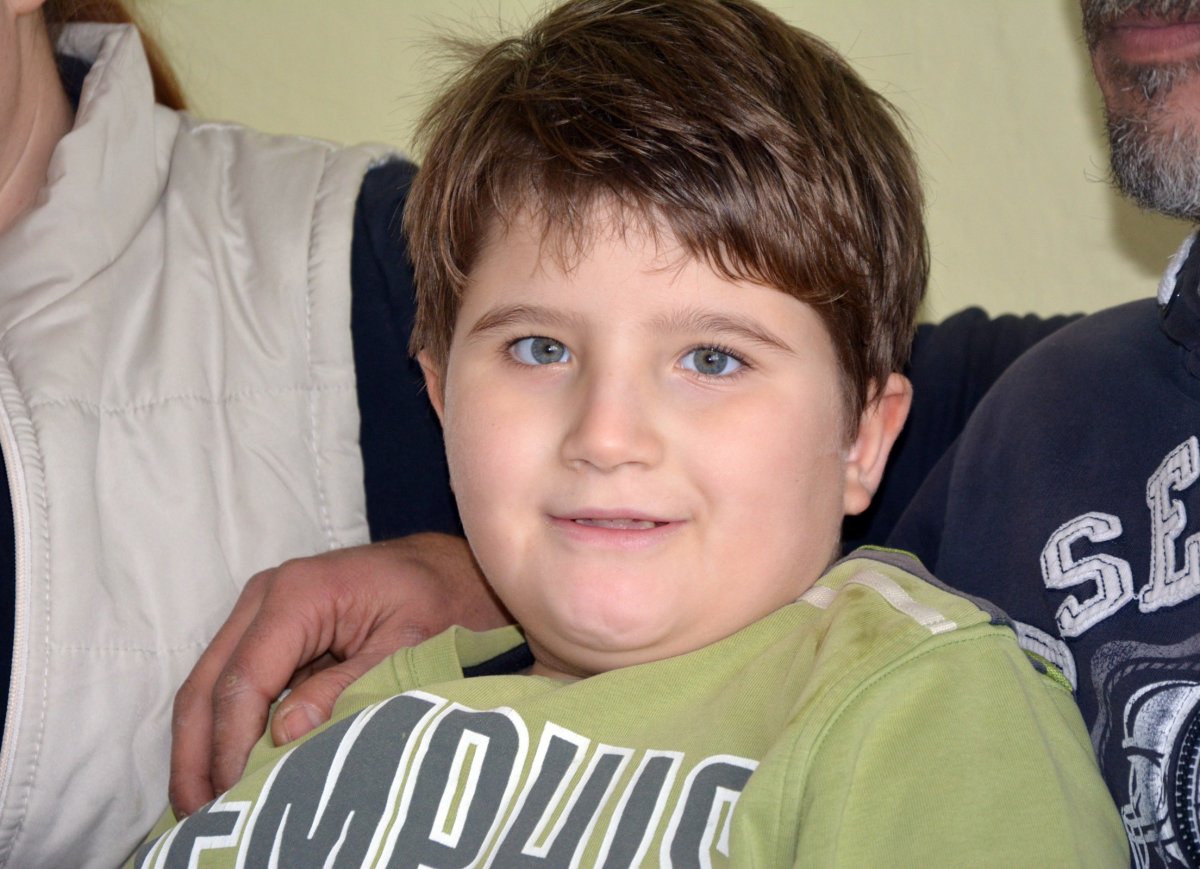 Prader Willi sendromu nedir