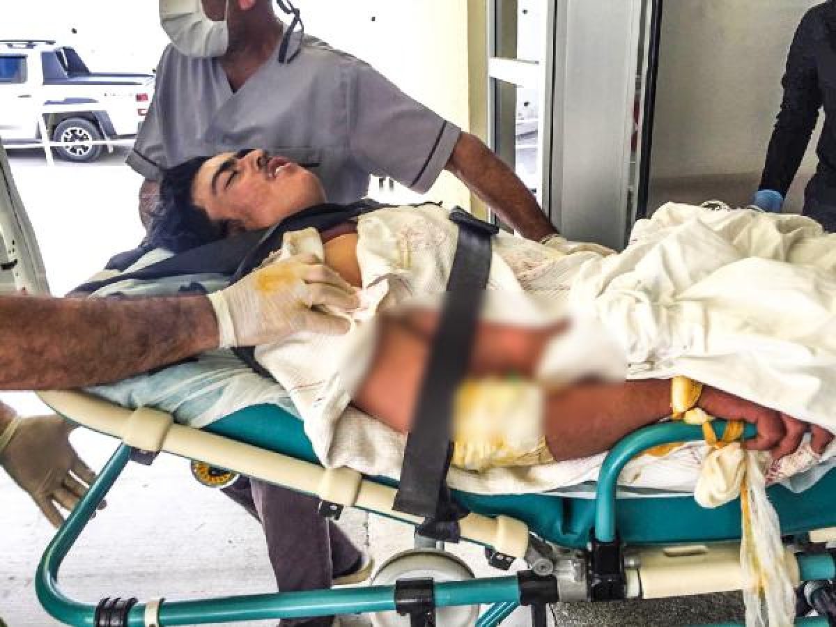 d Antalya'da, serada akıma kapılan genç ağır yaralandı