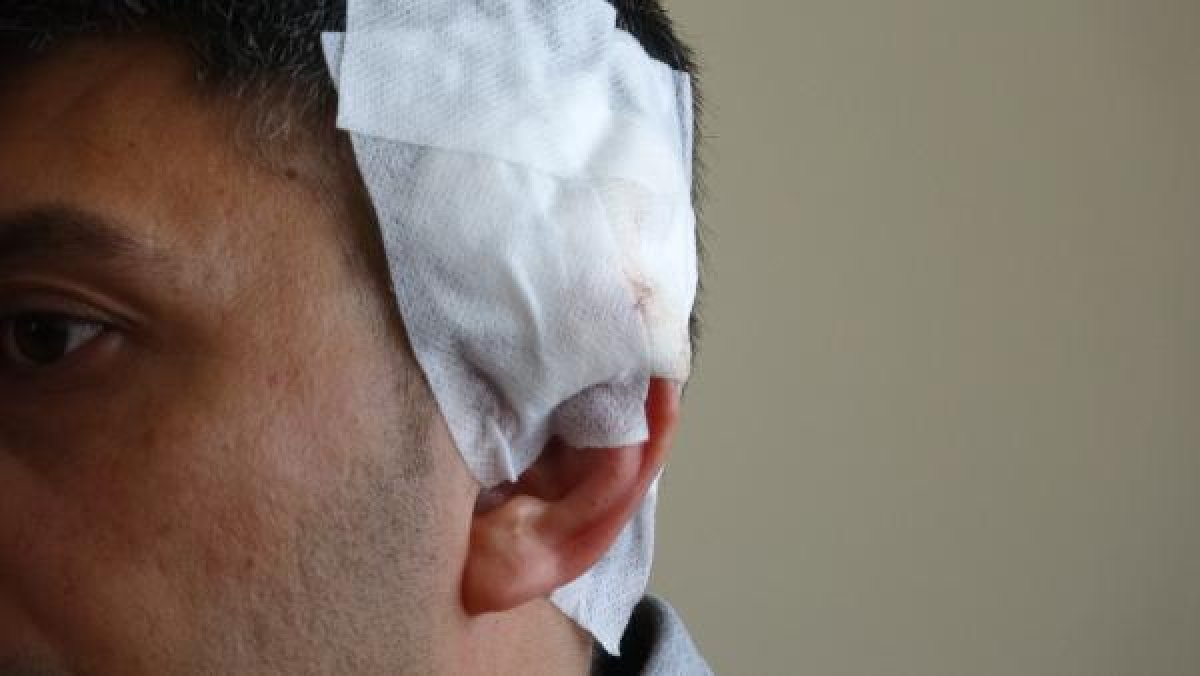 d Afyonkarahisar'da kürekle yaralanan karakol amiri konuştu