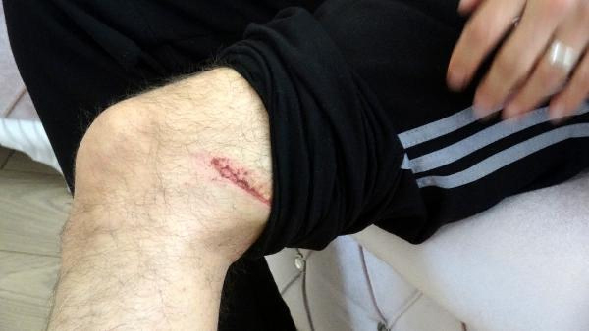 d Afyonkarahisar'da kürekle yaralanan karakol amiri konuştu