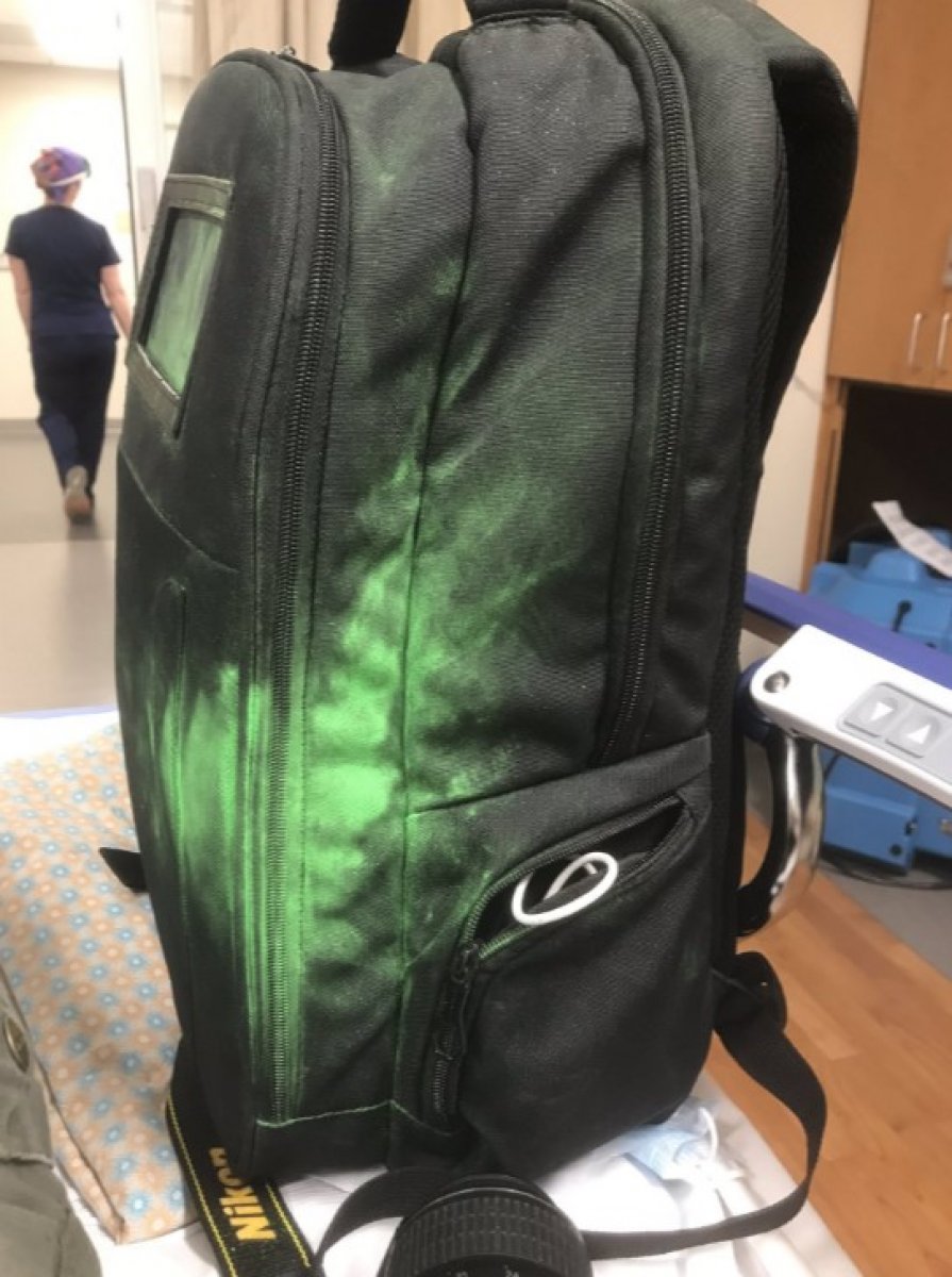 ABD’de protestolarda gazeteci gözünden vuruldu