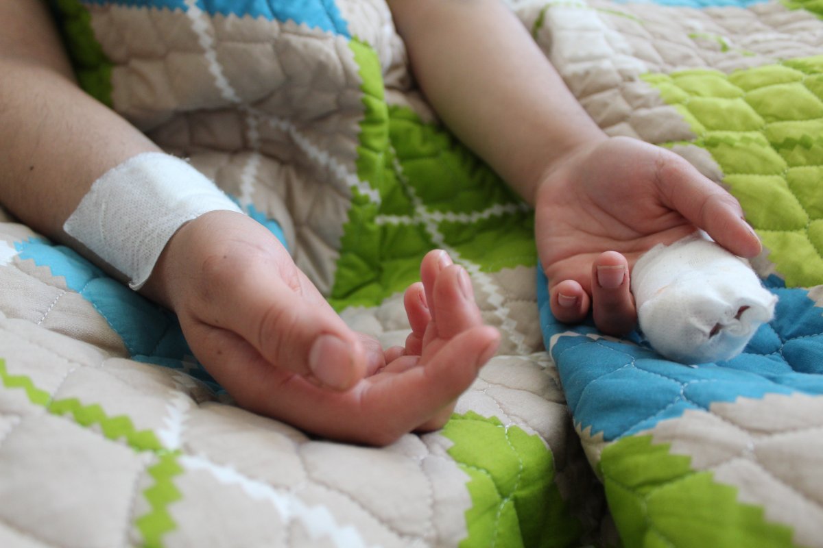 6 yıllık eşi tarafından yüzünden bıçaklandı