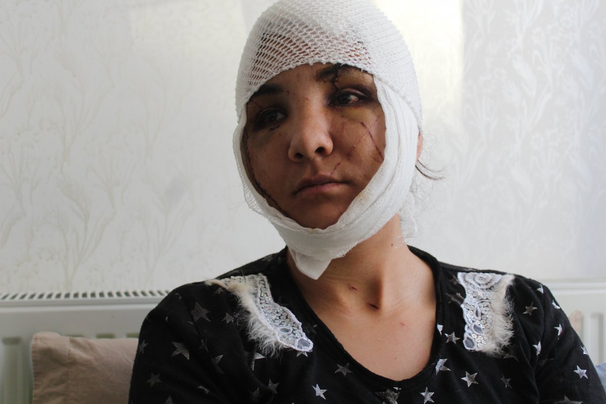 6 yıllık eşi tarafından yüzünden bıçaklandı