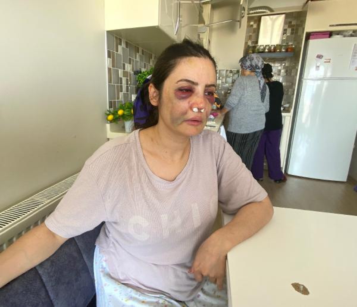 d Kartal'da boşanmak istediği eşi tarafından darbedildi