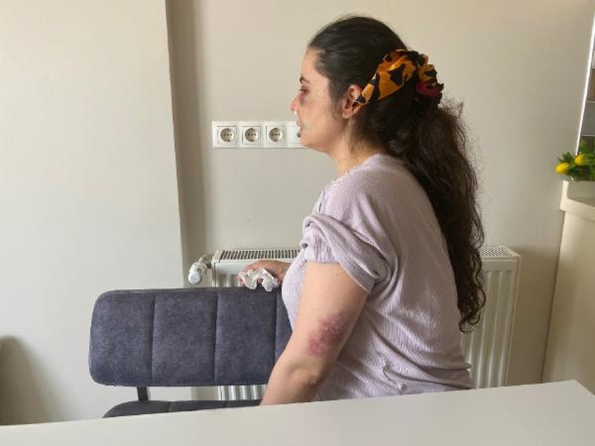 d Kartal'da boşanmak istediği eşi tarafından darbedildi