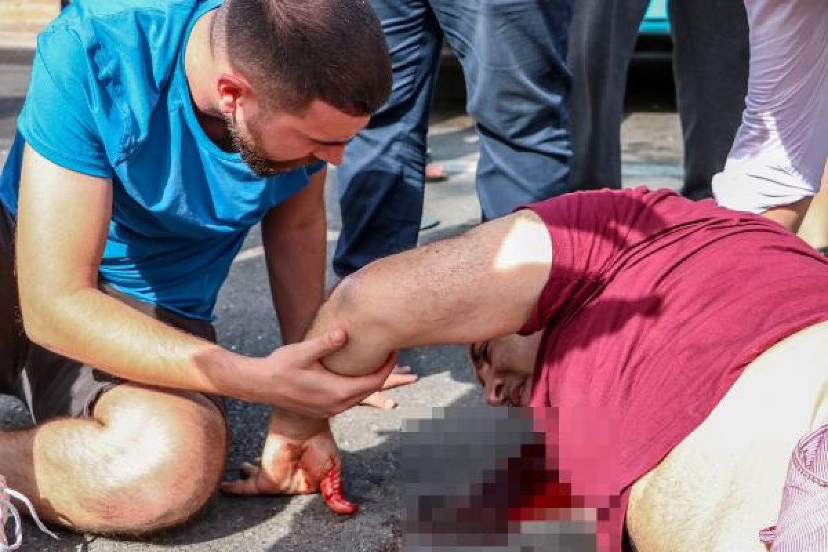 Antalya'da kaza yapan babasının başından ayrılmadı