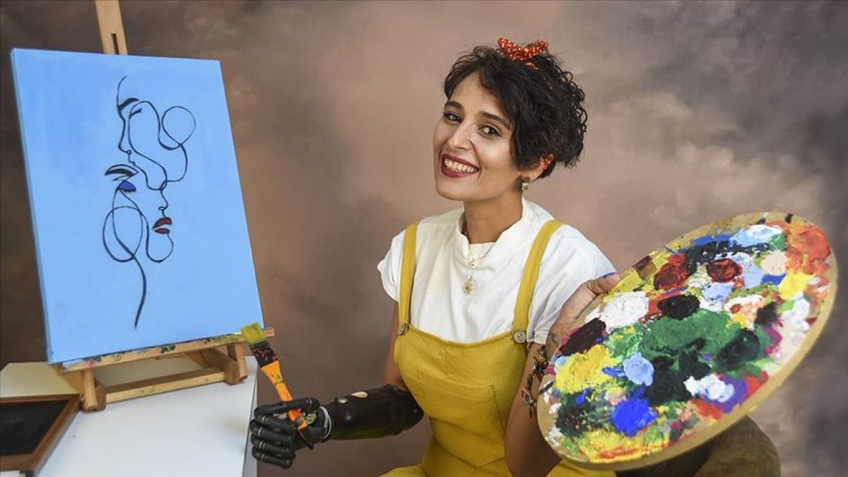 Gaziantepli Zübeyde, biyonik koluyla hayata tutundu