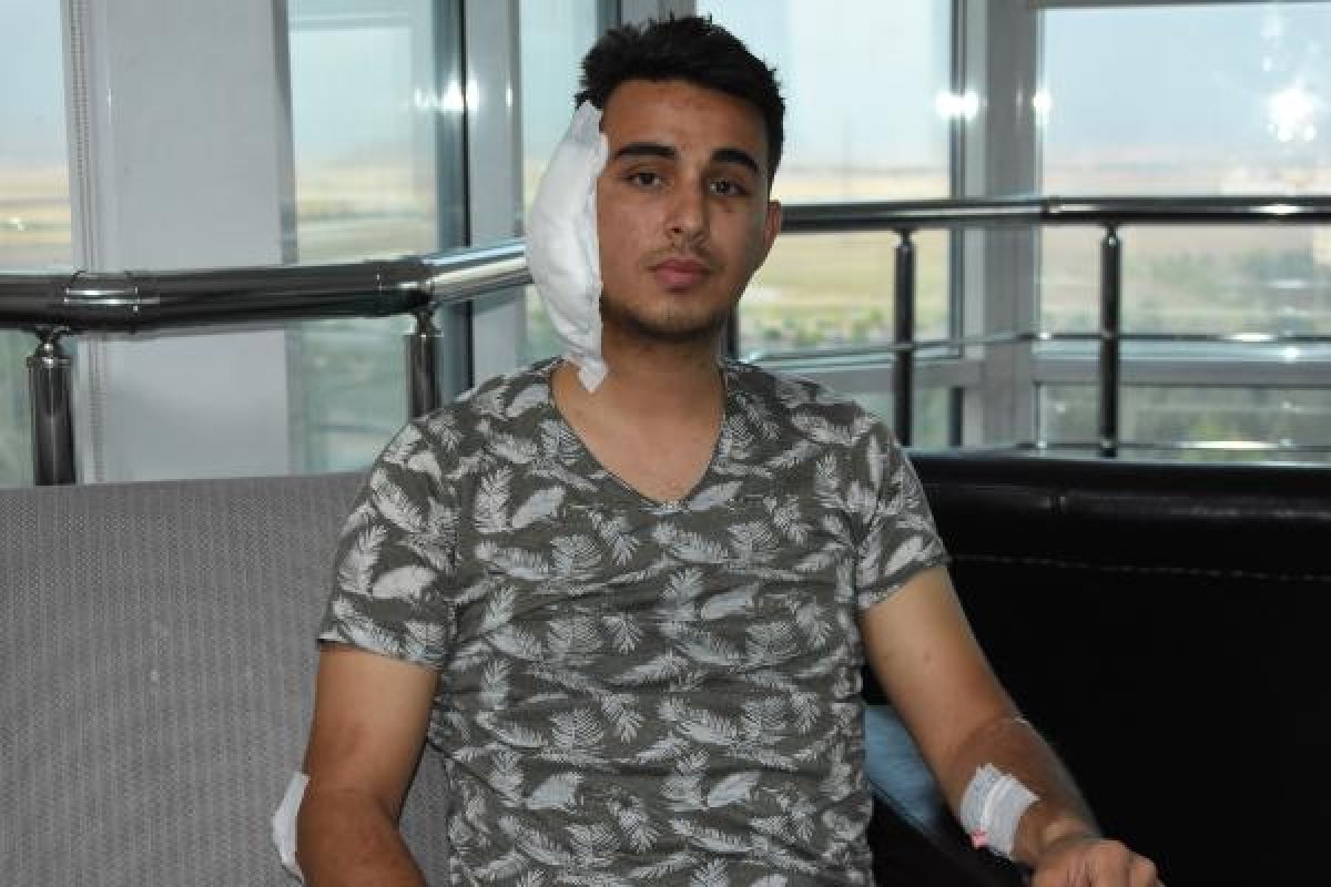 Köpek kavgasında postacının kulağı ısırıldı