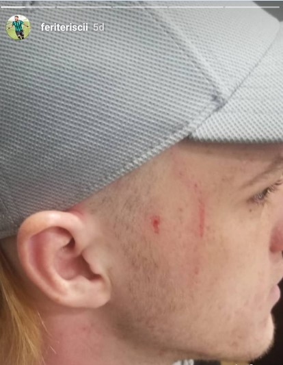 Amedspor'dan açıklama: Elinde jilet yoktu