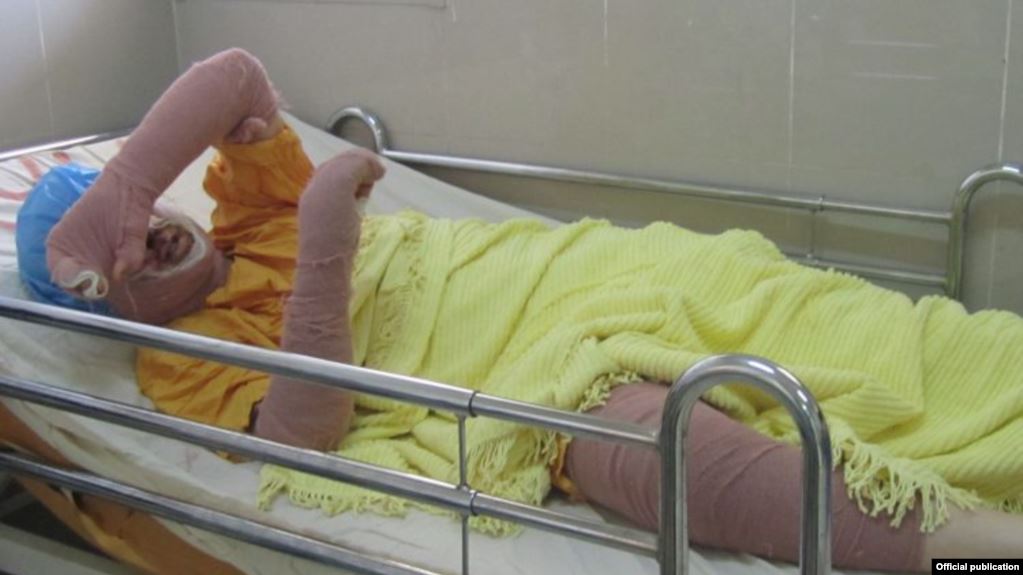 İran'da kendini yakan kadın taraftar hayatını kaybetti