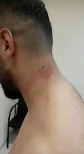 Mansur Çalar bu kez de tırnaklarıyla saldırdı