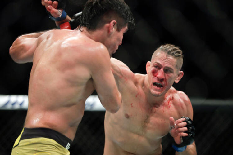 Kafes dövüşü maçında gözü çıkıyordu