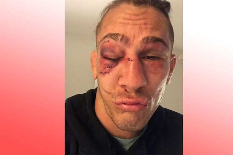 Kafes dövüşü maçında gözü çıkıyordu