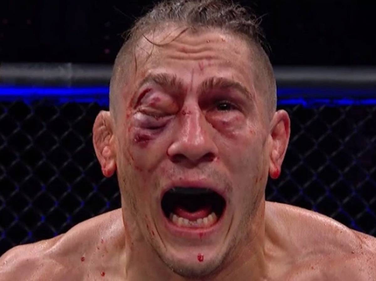 Kafes dövüşü maçında gözü çıkıyordu