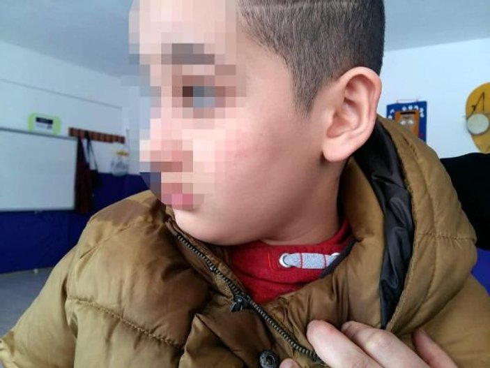 8 yaşındaki otizmli öğrenciyi döven öğretmen