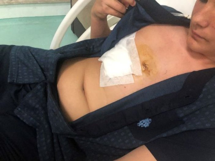Bursa'da 14 yaşındaki genç kalbinden bıçaklandı