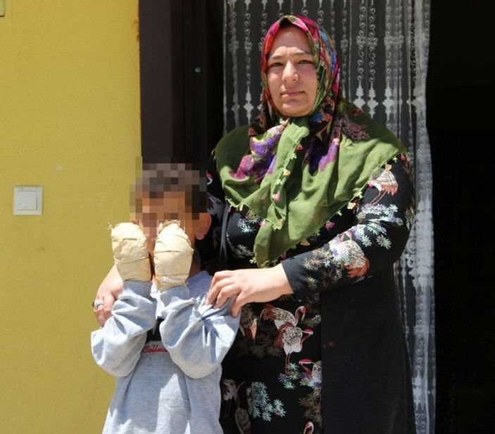 Erzurum'da komşu çocuğu, arkadaşının ellerini yaktı