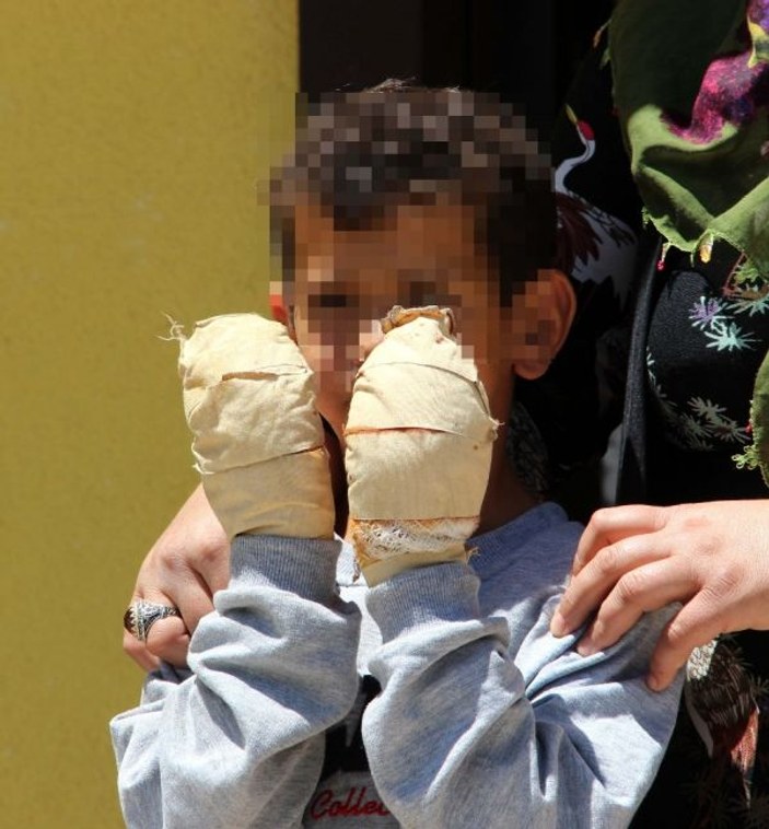 Erzurum'da komşu çocuğu, arkadaşının ellerini yaktı
